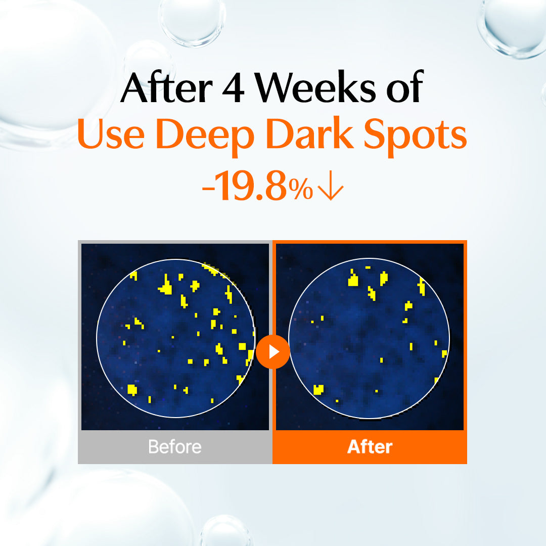 Official Klairs Vitamin Skin Prep Pad graphic showing four-week deep dark spot appearance improvement