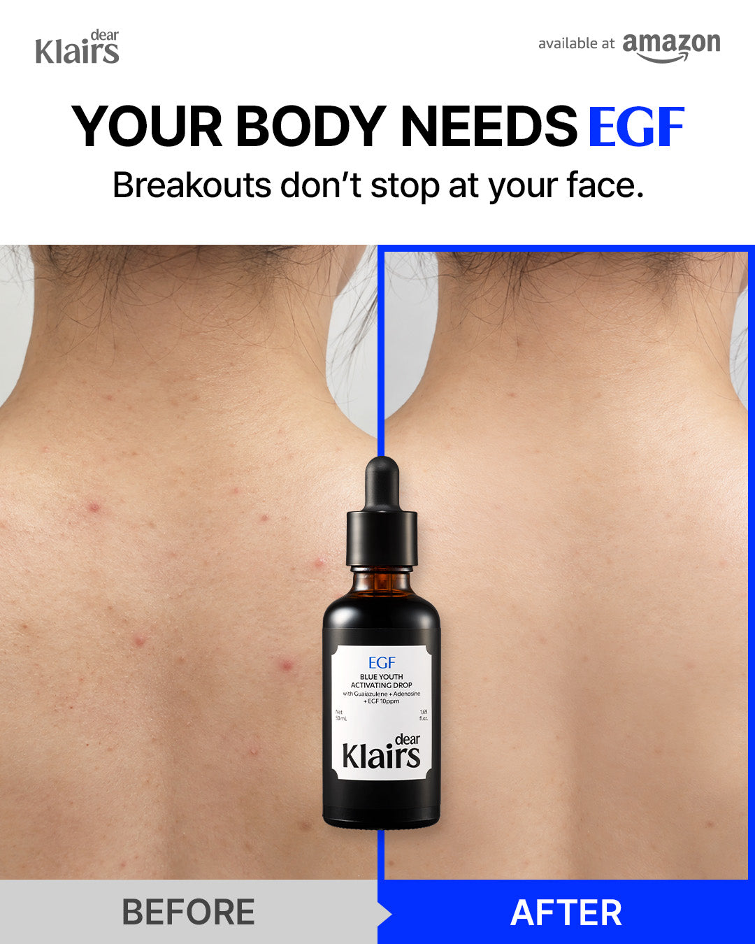 Korean EGF Repair Serum — DearKlairs Blue Youth Activating Drop 1.69 Fl Oz