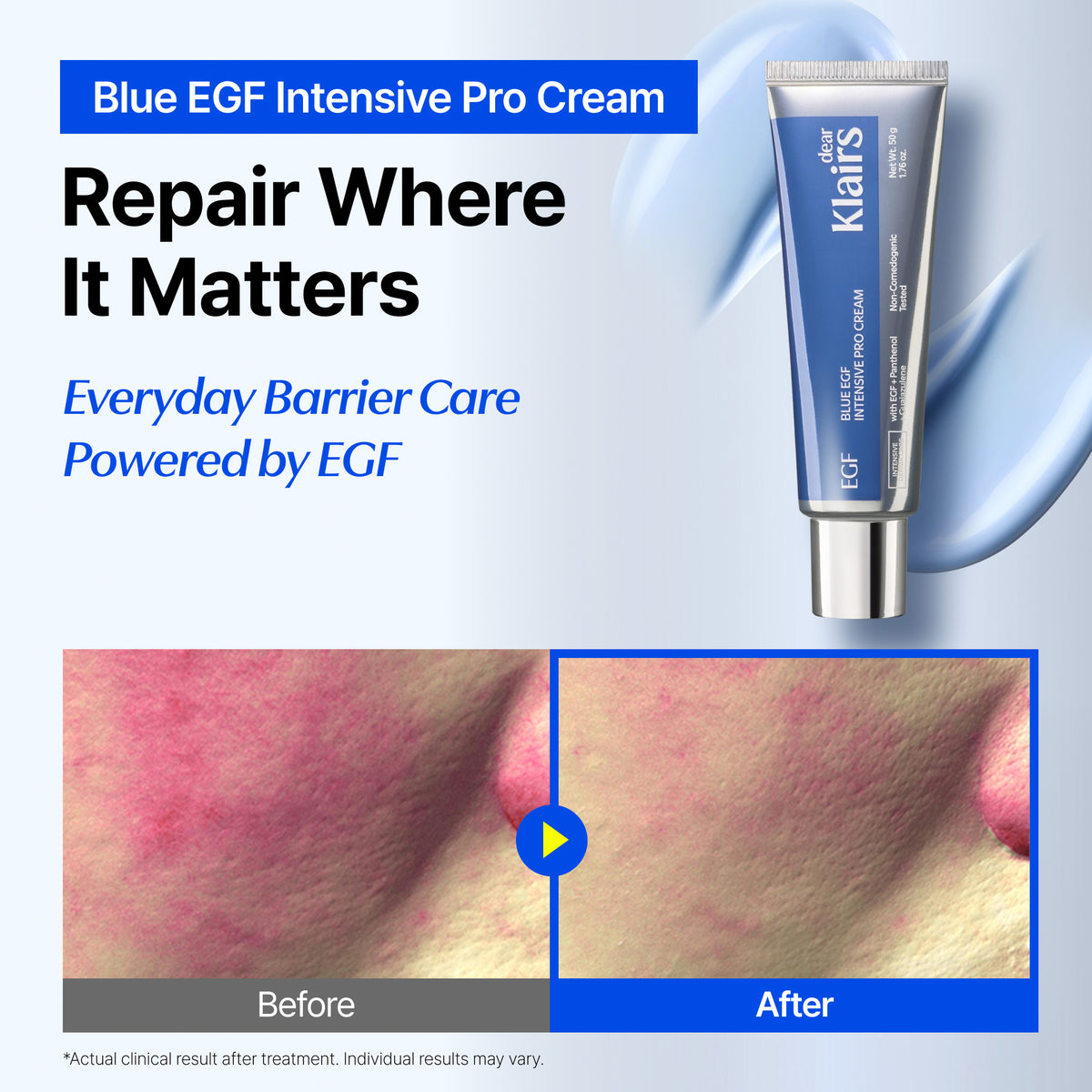 [⭐Limited Time Offer⭐] DearKlairs Blue EGF Intensive Pro Cream