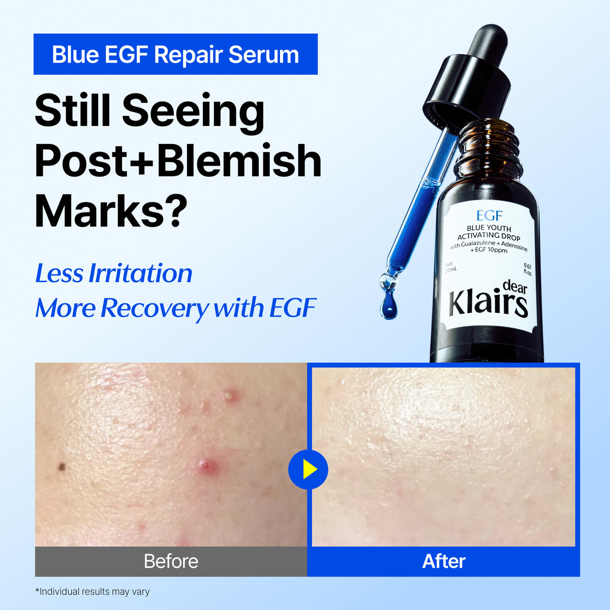 [🎁Holiday Special Duo🎁] DearKlairs Blue EGF Intensive Pro Cream & EGF Repair Serum