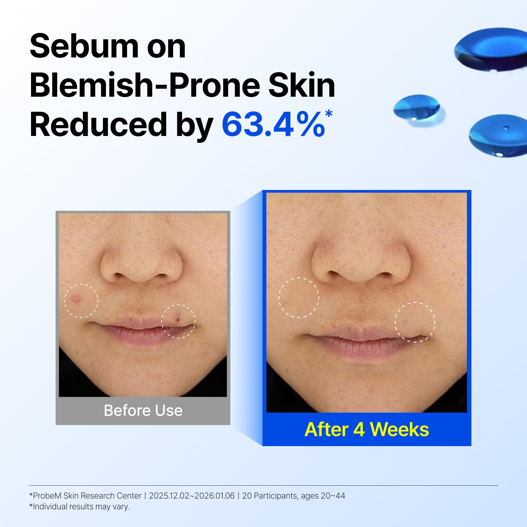 EGF Blue Youth Activating Drop