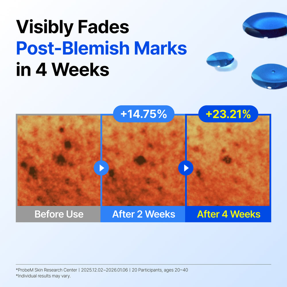 Klairs Blue Drop visibly fades post-blemish marks in 4 weeks graphic
