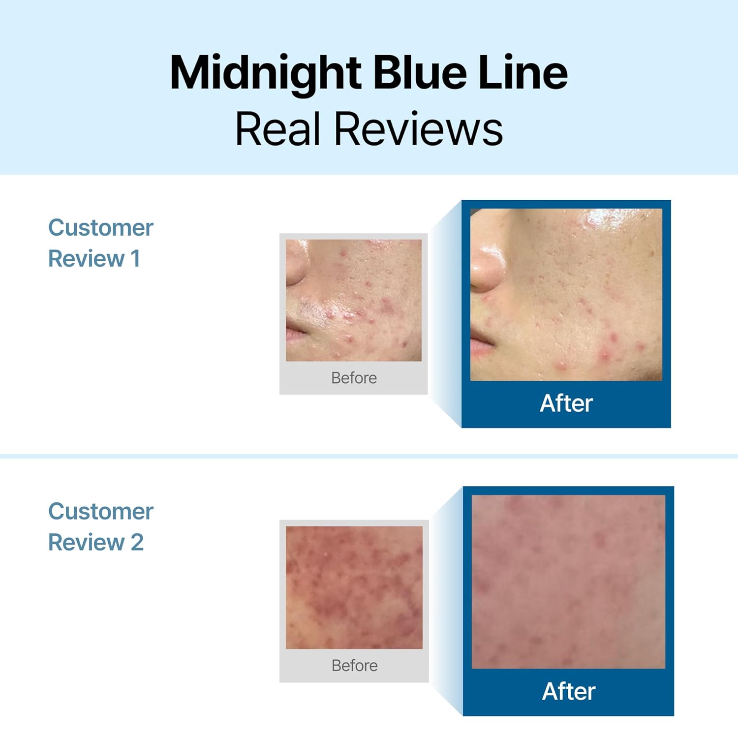Midnight Blue Line real customer review before and after graphic